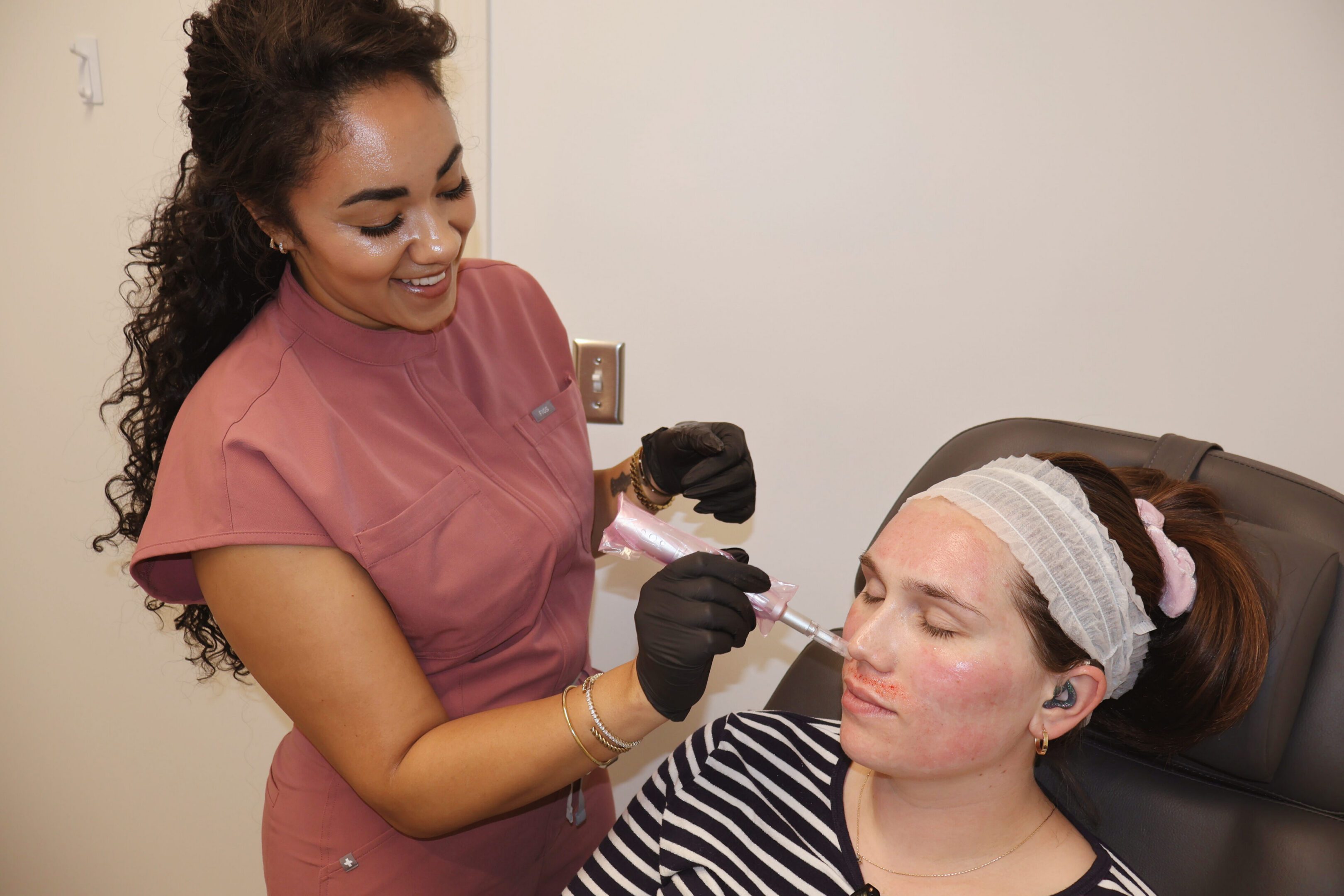 Microneedling treatment at SkynnGen Med Spa