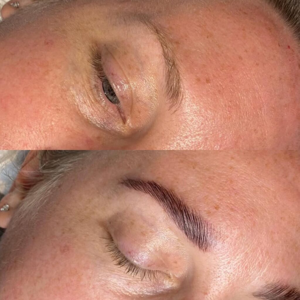 Eyebrow enhancement comparison